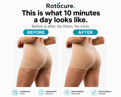 Rotocure Sculpt Roller